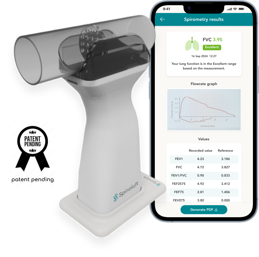 Spiroluft device and test results screen - with FS flowrate graph