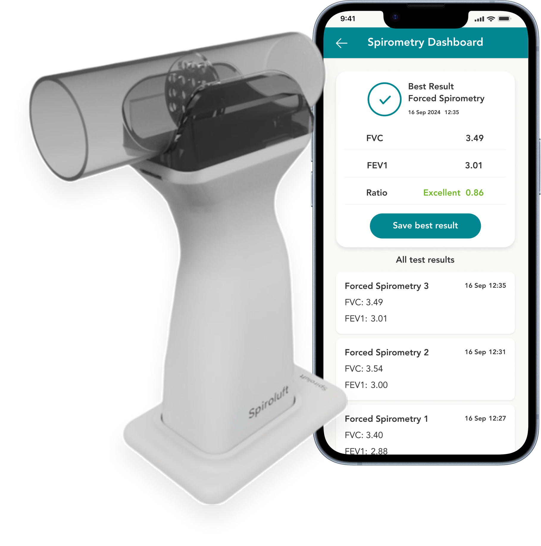 Spiroluft device and best result screen