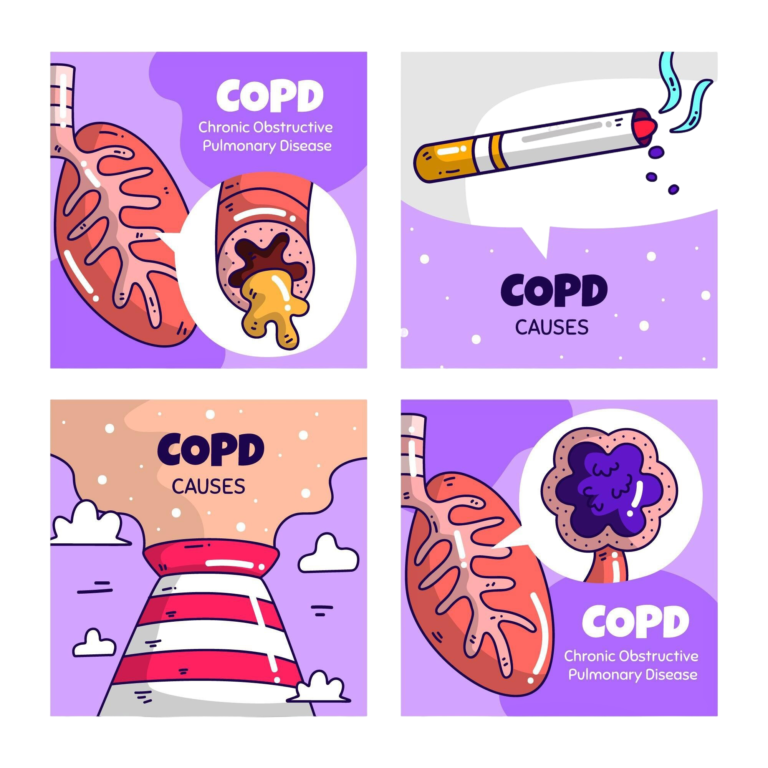 The Global Breath: Understanding the Impact of Smoking and Air Pollution on COPD