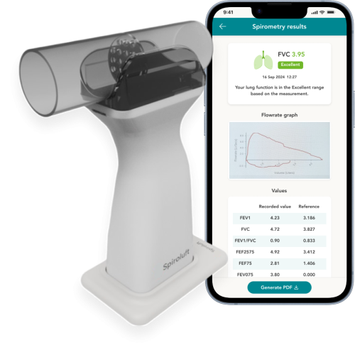 Spiroluft device and test results screen - with FS flowrate graph